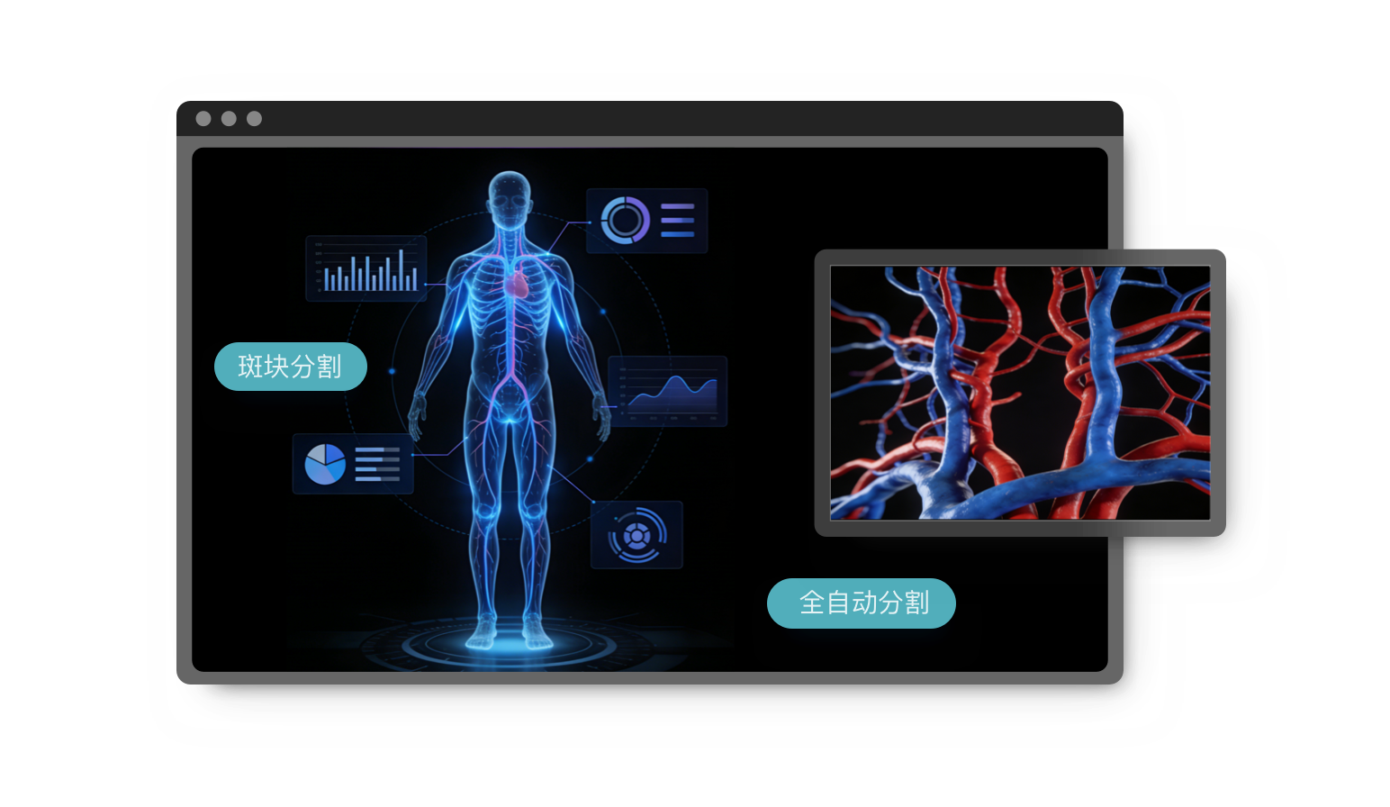 Vasis Artery CTA 全身动脉血管智能评估系统